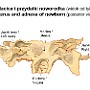 17. Macica i przydatki noworodka (widok od tyłu) - Uterus and adnexa of newborn (postetiow view)