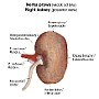 33. Nerka prawa (widok od tyłu) - Right kidney (posterior view)