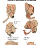 49. Warianty położenia wyrostka robaczkowego - Variants in the position of the appendix