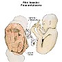 56. Płód i łożysko - Fetus and placenta