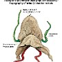 71. Topografia pęcherza moczowego u mężczyzny - Topography of urinary bladder in male