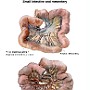 8. Jelito cienkie i jego krezka - Small intestine and mesentery