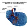 90. Żyła wrotna wątroby i tętnica wątrobowa wspólna - Portal vein and common hepatic artery