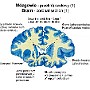 12. Mózgowie (1) (przekrój czołowy) - Brain (1) (coronal section)