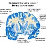 13. Mózgowie (2) (przekrój czołowy) - Brain (2) (przekrój czołowy)