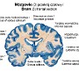 14. Mózgowie (3) (przekrój czołowy) - Brain (3) (frontal section)