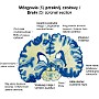 16. Mózgowie (5) (przekrój czołowy) - Brain (5) (coronal section)