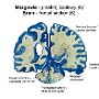 17. Mózgowie (6) (przekrój czołowy) - Brain (6) (frontal section)