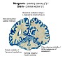 18. Mózgowie (7) (przekrój czołowy) - Brain (7) (coronal section)