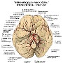 21. Tętnice mózgowia (widok od dołu) - Arteries of brain (inferior view)