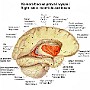 36. Komora boczna prawa i wyspa - Right lateral ventricle and insula