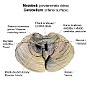 8. Móżdżek (powierzchnia dolna) - Cerebellum (inferior surface)